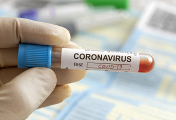 Елімізде бір тәулікте 34 адамнан коронавирус анықталды