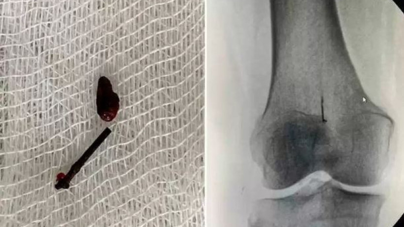  Алматы қаласы Орталық қалалық клиникалық ауруханасы 