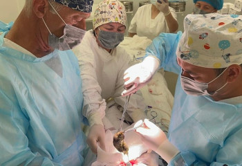 Более килограмма волос извлекли из желудка девочки в Таразе