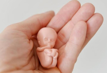 Жекеменшік емханаларда түсік жасататын жасөспірім қыздар қатары көбейген