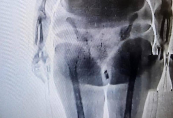 Телефон в интимном месте пыталась пронести женщина в СИЗО Актау