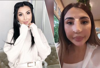 Әнші Сиви Махмуди мұрнын сындырды