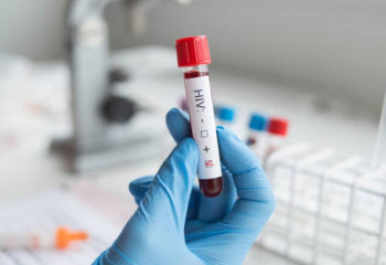 Алматыда емделіп жатқан 3 адамнан АИТВ-ның оң мәртебесі анықталды