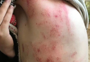 Павлодарда соққыға жығылған жасөспірімнің ісін әкім бақылауына алды