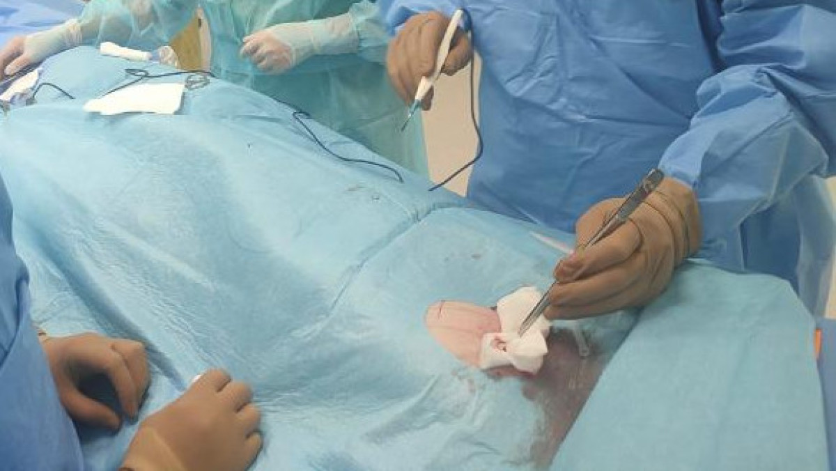 Алматинцам впервые имплантировали кардиомонитор