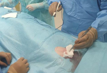 Алматинцам впервые имплантировали кардиомонитор