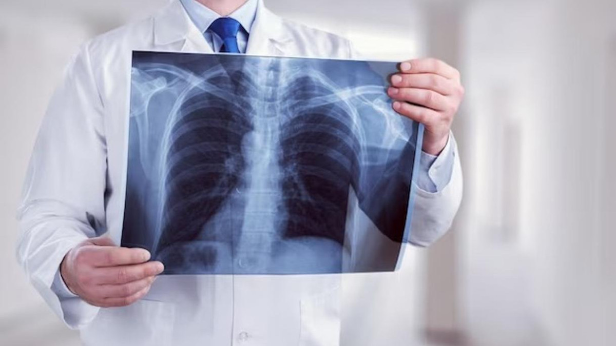 Случаи заболевания туберкулезом в Казахстане стали реже