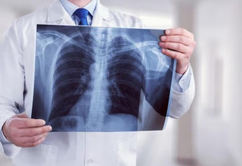 Случаи заболевания туберкулезом в Казахстане стали реже