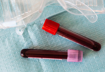 В РК снизилась смертность от болезней системы кровообращения - Минздрав