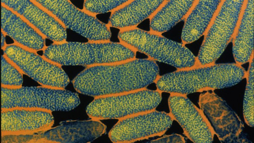  SCIENCE PHOTO LIBRARY 