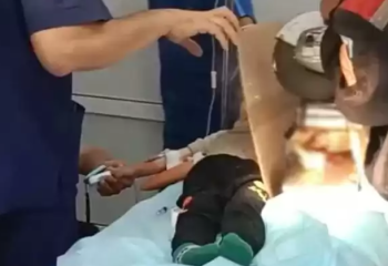 Шымкентте 3 жасар баланың қолы еттартқышқа қысылып қалды