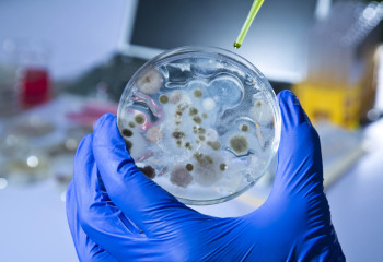 Что такое сибирская язва и почему она так опасна