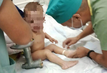 Двухлетний малыш едва не потерял руку в мясорубке