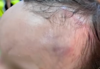 Павлодардағы балабақшада 2 жасар бала соққыға жығылған