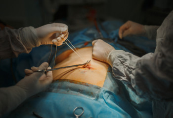 Завещаю свое тело на органы: за 10 лет в Казахстане 16,6% пересадок органов проведено от посмертных доноров