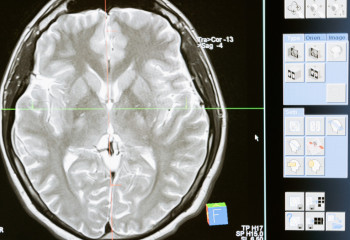 Researchers unveil atlas of human brain