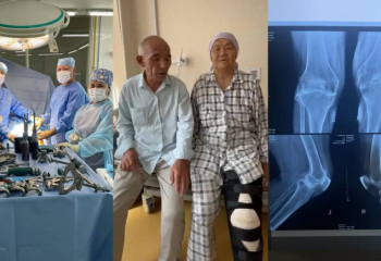 Ортопеды 7 горбольницы Алматы поставили на ноги пенсионерку, прикованную к коляске