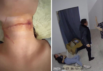 Тамағын тіліп жіберген: Талдықорғанда ер адам бұрынғы сүйіктісіне кеңсе пышағымен шабуылдады