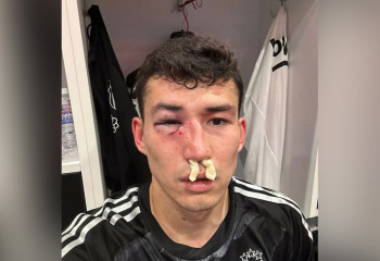 Зайнутдинов получил жуткую травму перед решающими матчами сборной Казахстана в отборе Евро-2024