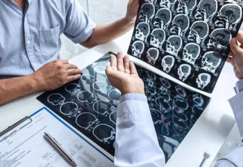 Денсаулық сақтау министрлігі неврологиялық көмекті жақсартудың жаңа стандартын қабылдады