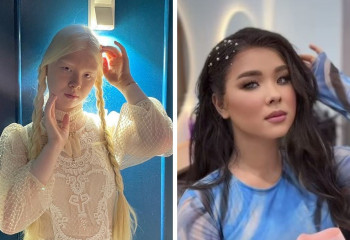 Девушка-альбинос из Актау стала брюнеткой и поразила казахстанцев