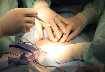 Қатерлі ісігінің соңғы сатысындағы науқас аман қалды