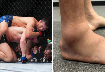 Шавкат Рахмонов перед боем с Томпсоном ходил на костылях