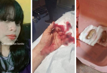 Девушка отпилила пальцы брату за то что он съел её йогурт