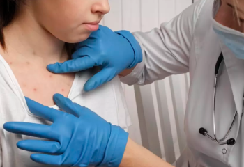 Қазақстан қызылшаның таралуы бойынша көш бастады