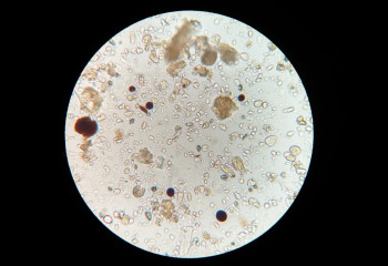 Біз ойламаған ең лас 10 жер