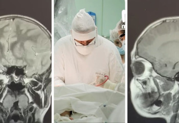 Червь в мозг: школьник из Челябинска заразился паразитом от бродячей собаки