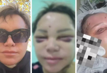 Сұлулық салонына барған көкшетаулық тұрғын өмірімен қош айтыса жаздаған