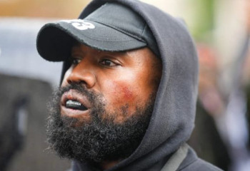 Kanye West shocks fans as he gets $850,000 titanium teeth