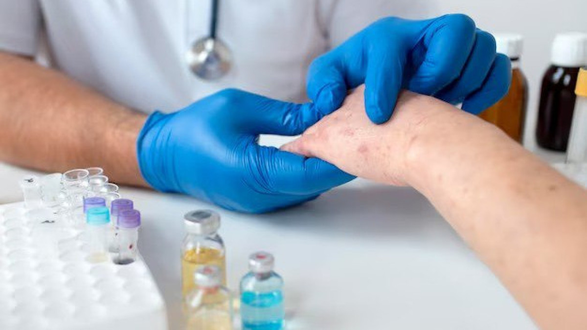 Rise in measles cases registered in  Kostanay region