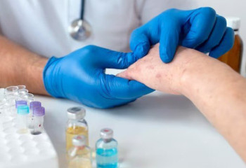 Rise in measles cases registered in  Kostanay region