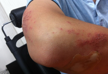 Заключенный избил медиков в колонии Уральска