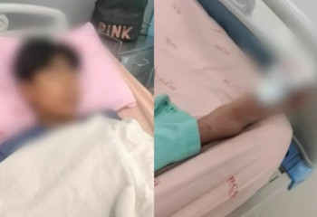 Сұлулығы үшін таяқ жеді: 15 жасар жасөспірімді қатарластары өлімші етіп сабады