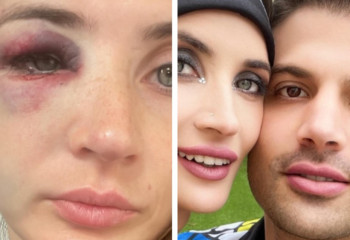 Қазақстандық волейболшы қыздың өміріне қауіп төніп тұр