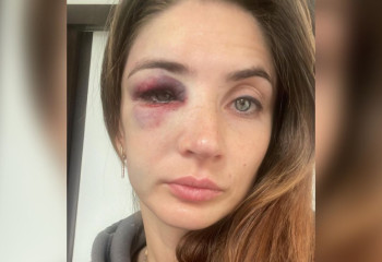 Жертвой домашнего насилия стала известная казахстанская волейболистка