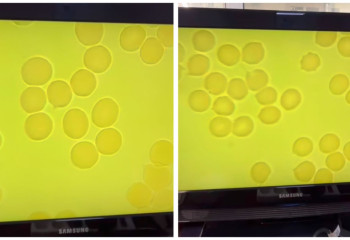 Чистую кровь у соблюдающего оразу мужчины показала казахстанский гематолог