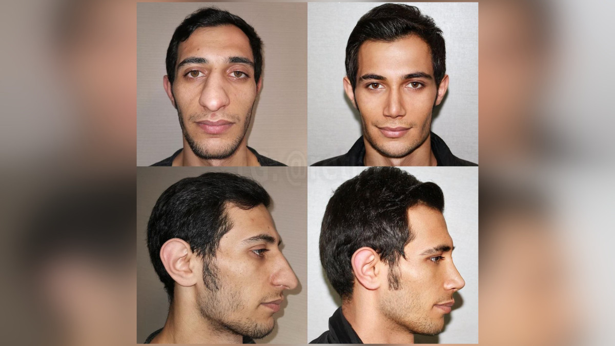  instagram.com/estemedistanbultr 