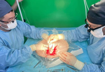 Қызылордада 24 жасар қызға әпкесі донор болды