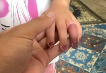 Қызылордада бес жасар қыздың саусағындағы сақинаны құтқарушылар шешіп берді