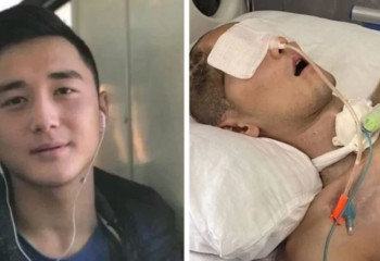 Әлназарова әскерден мүгедек болып оралған Ербаян Мұхтардың жағдайы туралы айтты