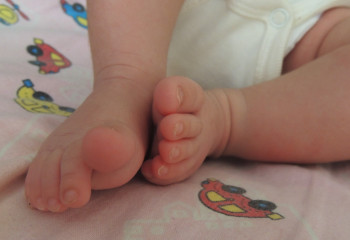 Шымкенттік дәрігерлер небәрі 970 грамм боп туған сәбиді аман алып қалды