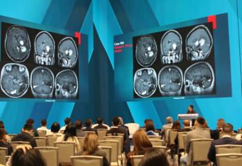 Астанадағы хирургтар форумында тікелей эфирде 6 операция жасалды