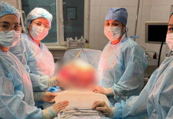 Гигантскую миому весом 15 кг удалили таразские врачи 50-летней женщине