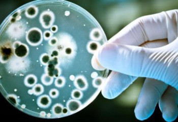 Қазақстанда Сібір жарасының жиілігі екі есе төмендеді