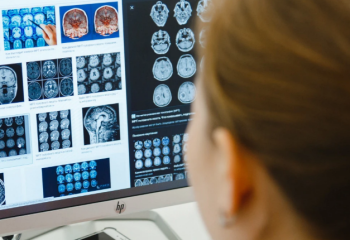 Жанар Оспанова: 10 инсульттің 8-нің алдын алып, тоқтатуға болады