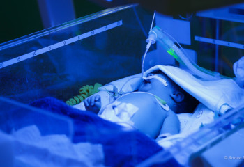 День недоношенных детей: выживаемость малышей с экстремально низкой массой тела выросла в 4 раза в РК